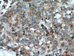 GRAMD1B Antibody in Immunohistochemistry (Paraffin) (IHC (P))
