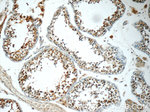 WFDC3 Antibody in Immunohistochemistry (Paraffin) (IHC (P))