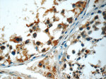 WFDC3 Antibody in Immunohistochemistry (Paraffin) (IHC (P))