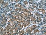 WFDC3 Antibody in Immunohistochemistry (Paraffin) (IHC (P))