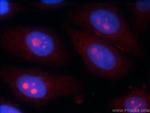 KIAA0774 Antibody in Immunocytochemistry (ICC/IF)