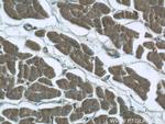 KIAA0774 Antibody in Immunohistochemistry (Paraffin) (IHC (P))