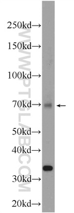 DHX35 Antibody in Western Blot (WB)