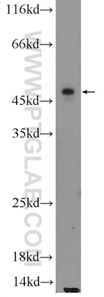 ILK Antibody in Western Blot (WB)
