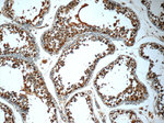 TMEM213 Antibody in Immunohistochemistry (Paraffin) (IHC (P))