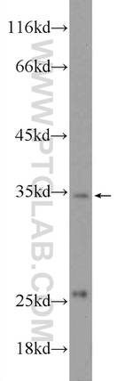 C2orf47 Antibody in Western Blot (WB)
