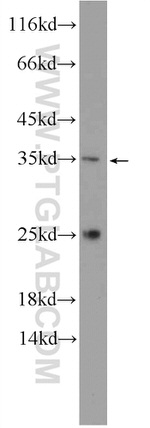 C2orf47 Antibody in Western Blot (WB)