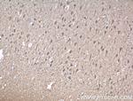 SRBD1 Antibody in Immunohistochemistry (Paraffin) (IHC (P))
