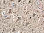 SRBD1 Antibody in Immunohistochemistry (Paraffin) (IHC (P))