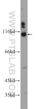 SRBD1 Antibody in Western Blot (WB)