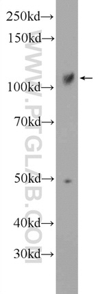 SRBD1 Antibody in Western Blot (WB)