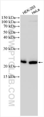 KEPI Antibody in Western Blot (WB)