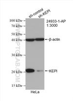 KEPI Antibody in Western Blot (WB)