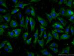 ADAMTS12 Antibody in Immunocytochemistry (ICC/IF)