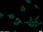 SEC61alpha Antibody in Immunocytochemistry (ICC/IF)