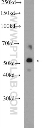 SEC61alpha Antibody in Western Blot (WB)