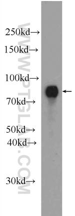 ProSAPiP1 Antibody in Western Blot (WB)
