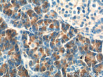 CTRB1 Antibody in Immunohistochemistry (Paraffin) (IHC (P))