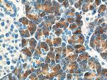 CTRB1 Antibody in Immunohistochemistry (Paraffin) (IHC (P))