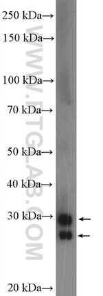 CTRB1 Antibody in Western Blot (WB)