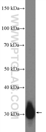 CTRB1 Antibody in Western Blot (WB)
