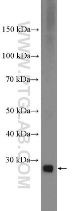 CTRB1 Antibody in Western Blot (WB)