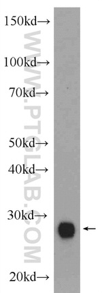 CTRB1 Antibody in Western Blot (WB)