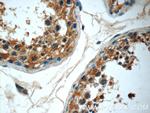 RPL39L Antibody in Immunohistochemistry (Paraffin) (IHC (P))