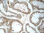 RPL39L Antibody in Immunohistochemistry (Paraffin) (IHC (P))