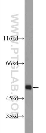 KDM4A Antibody in Western Blot (WB)