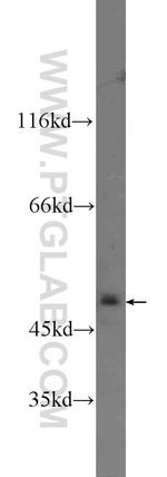 KDM4A Antibody in Western Blot (WB)
