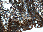 ME2 Antibody in Immunohistochemistry (Paraffin) (IHC (P))