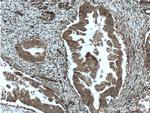 ME2 Antibody in Immunohistochemistry (Paraffin) (IHC (P))