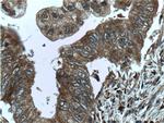 ME2 Antibody in Immunohistochemistry (Paraffin) (IHC (P))
