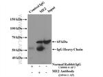 ME2 Antibody in Immunoprecipitation (IP)