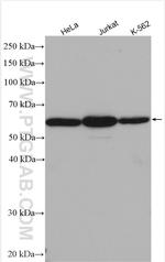 ME2 Antibody in Western Blot (WB)