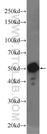 ME2 Antibody in Western Blot (WB)