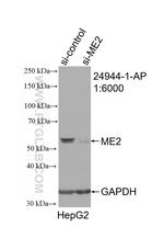 ME2 Antibody in Western Blot (WB)