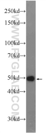 ME2 Antibody in Western Blot (WB)