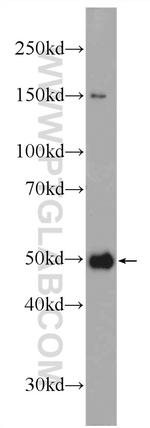 ME2 Antibody in Western Blot (WB)
