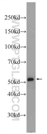 ME2 Antibody in Western Blot (WB)
