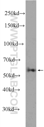 ME2 Antibody in Western Blot (WB)