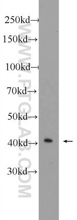 PRPF38A Antibody in Western Blot (WB)