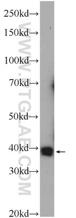 PRPF38A Antibody in Western Blot (WB)