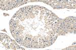 KIAA0182 Antibody in Immunohistochemistry (Paraffin) (IHC (P))
