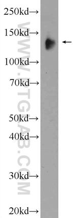 KIAA0182 Antibody in Western Blot (WB)