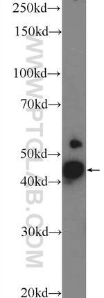 MCUR1 Antibody in Western Blot (WB)
