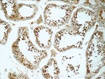 HIC1 Antibody in Immunohistochemistry (Paraffin) (IHC (P))