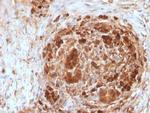 Ferritin, Heavy Chain (FTH) Monoclonal Antibody (FTH, 2082)