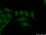 ZNF30 Antibody in Immunocytochemistry (ICC/IF)